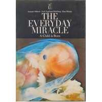 Everyday Miracle: Child is Born