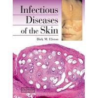 Infectious Diseases Of The Skin